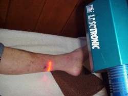 Low Level Laser Therapy - LLLT Scanner